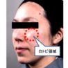 “頬の動きの変化”が老けた印象を与える ポーラ化成研究