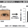ポーラ化成工業、「目のまわりのくぼみ」を改善するエキス発見