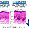 シミが肌に固定化する原因の一つにタンパク質「CXCR4」が関係