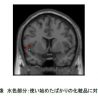 資生堂、化粧品に対する気持ちの変化を脳科学研究で解明