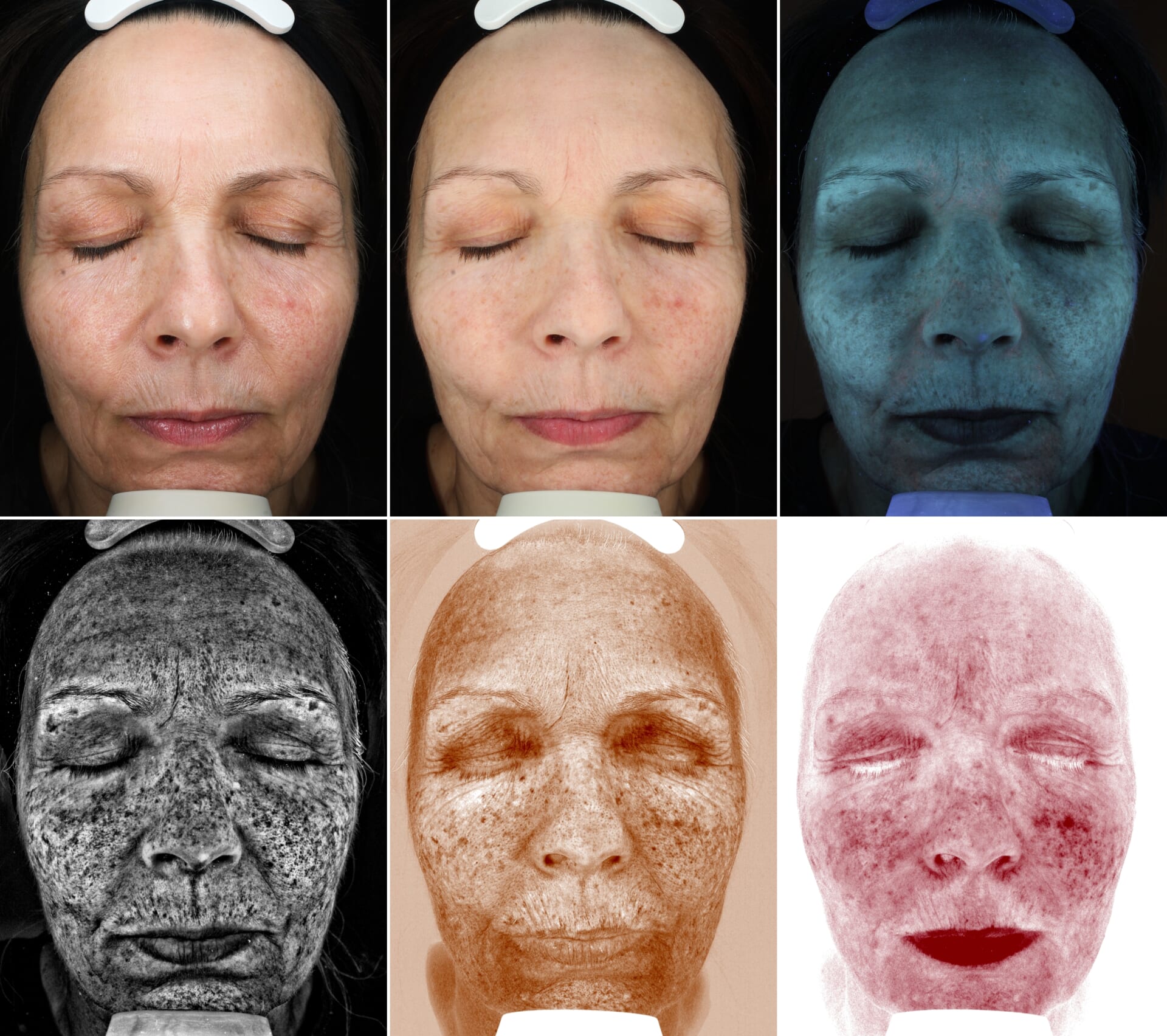 老化の科学と美容医療 細胞から見るエイジングケアのアプローチ