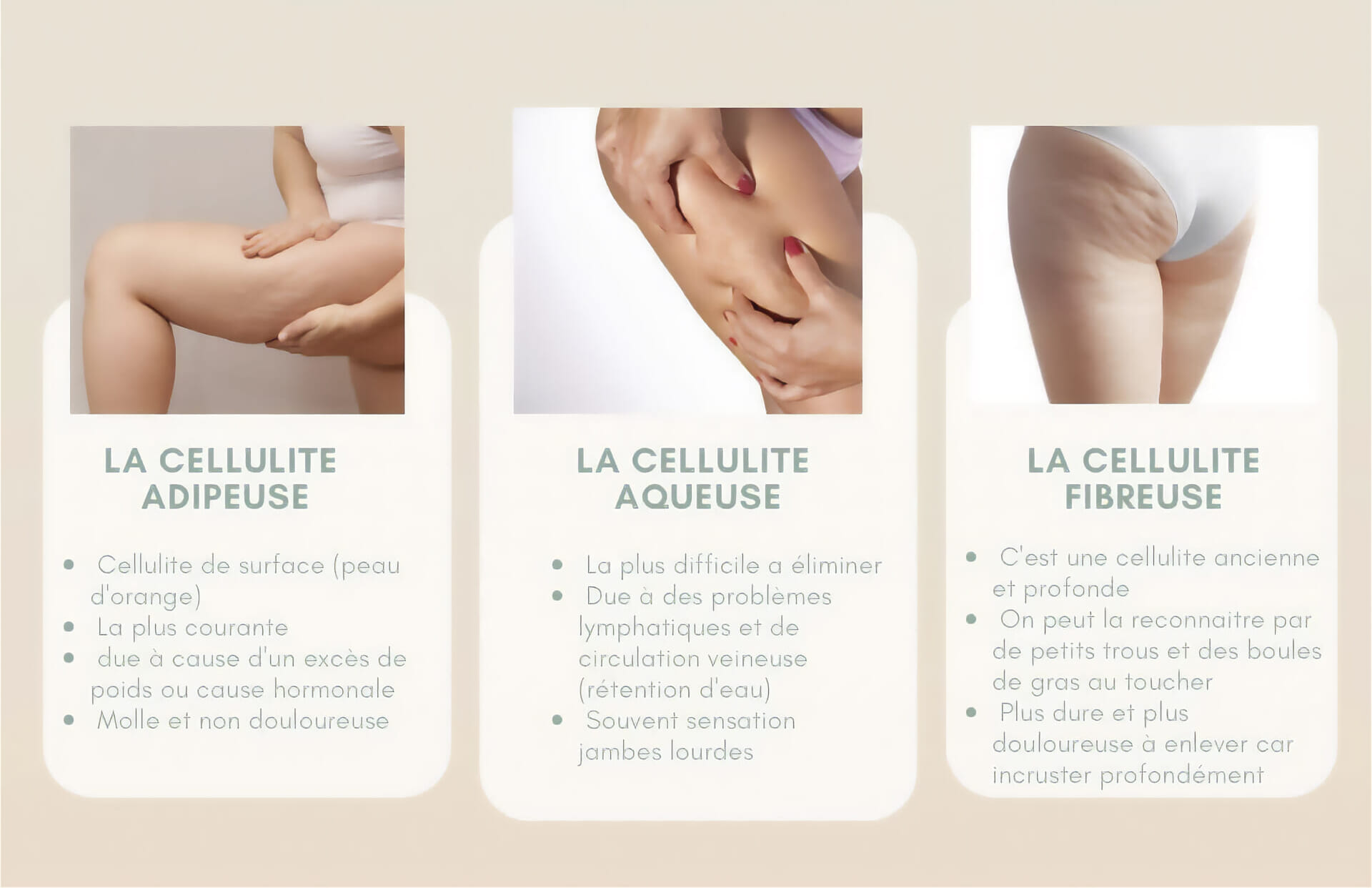 皮下組織から読み解くセルライトの原因と対策